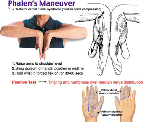 median nerve compression test|reverse phalen's test positive.